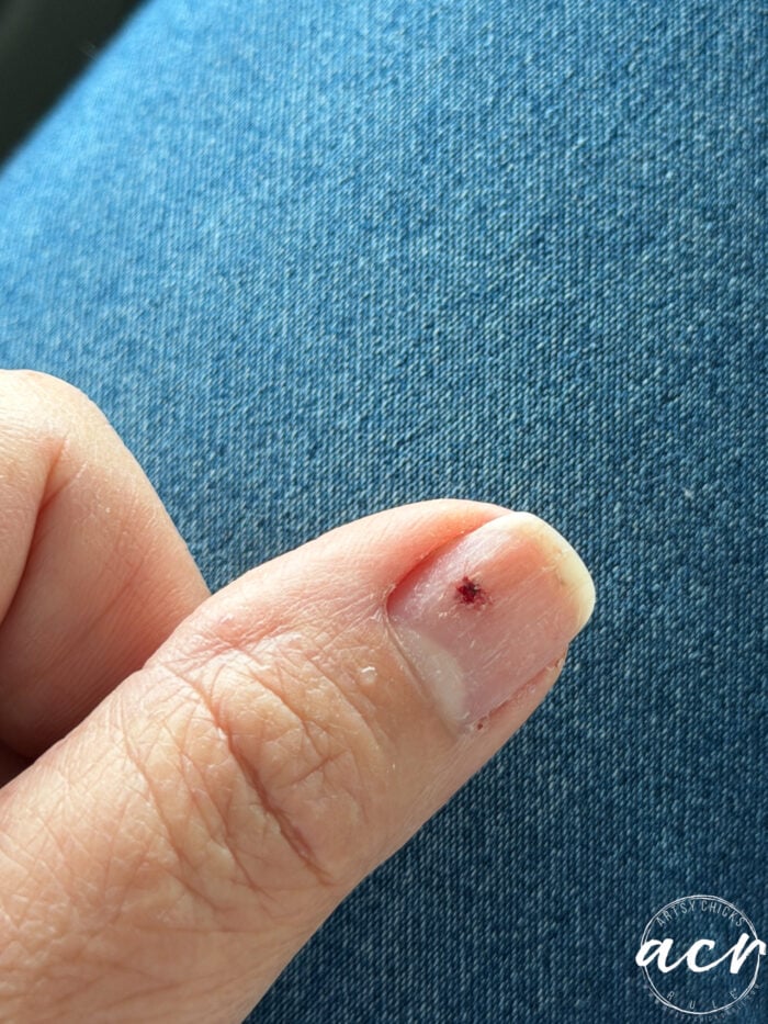 A close-up of a thumb with a small cut and dried blood near the base of the nail, set against blue denim fabric, beside delicate flower petal resin earrings.